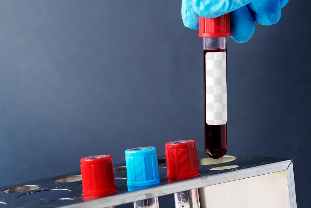 Doctor holding a blood test tube transparent png