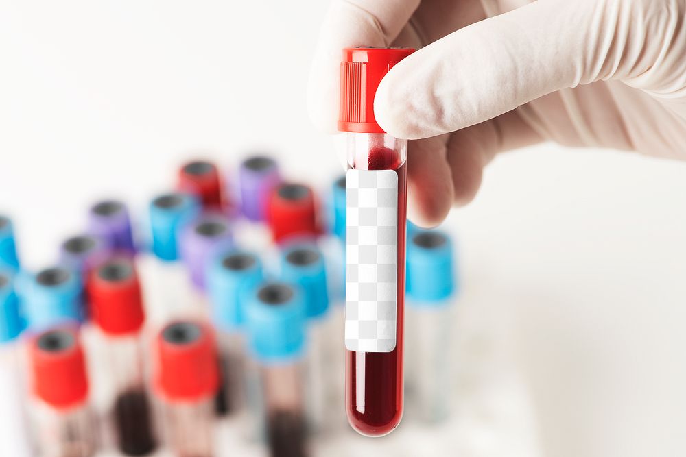 Doctor holding a blood test tube transparent png