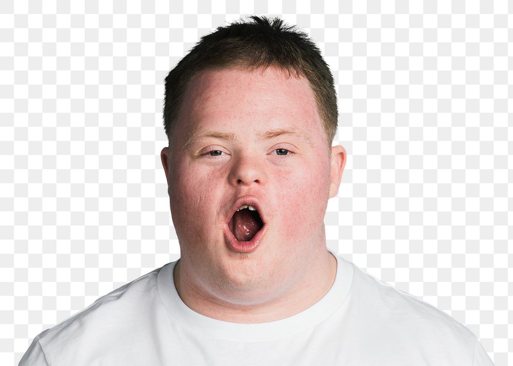 Tired boy with down syndrome yawning 