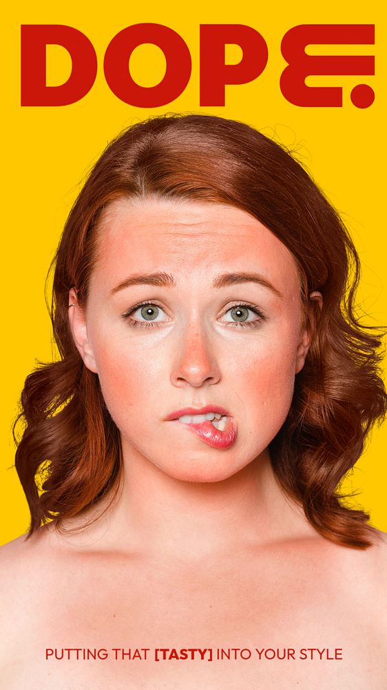 Sunburn woman Instagram story template, Summer aesthetic