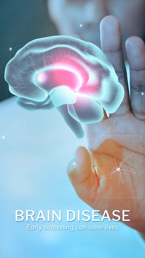 Brain disease Instagram story template, editable medical technology design