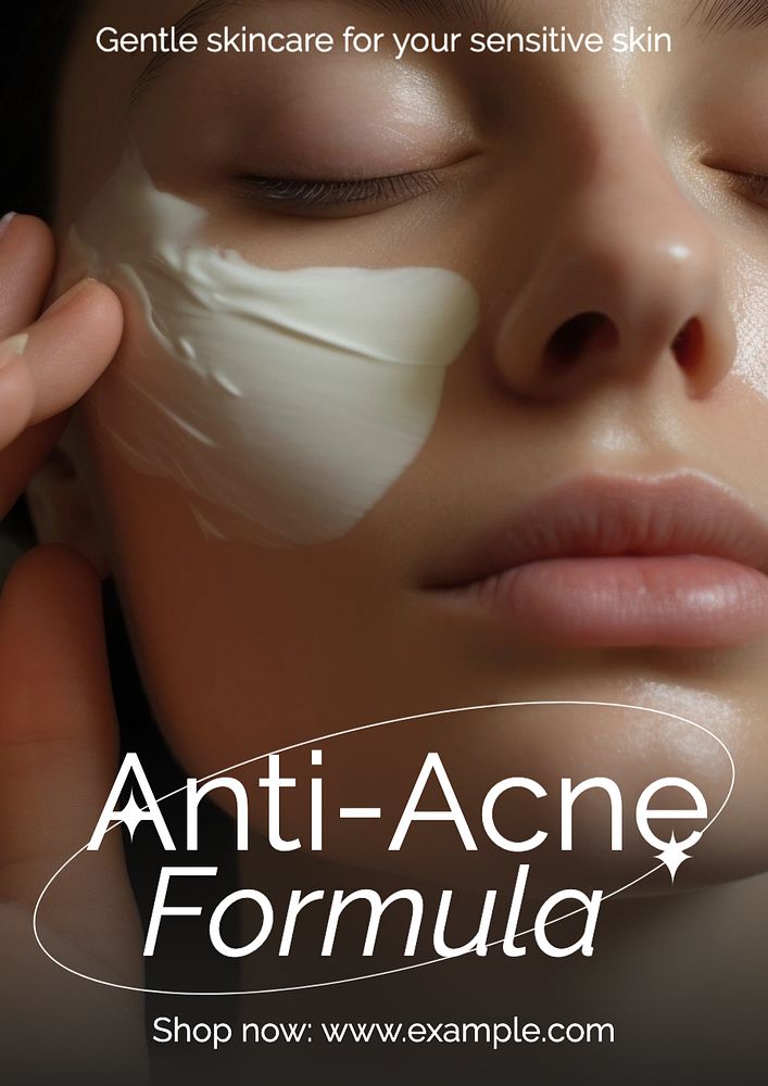 Anti-acne skincare poster template, editable text and design