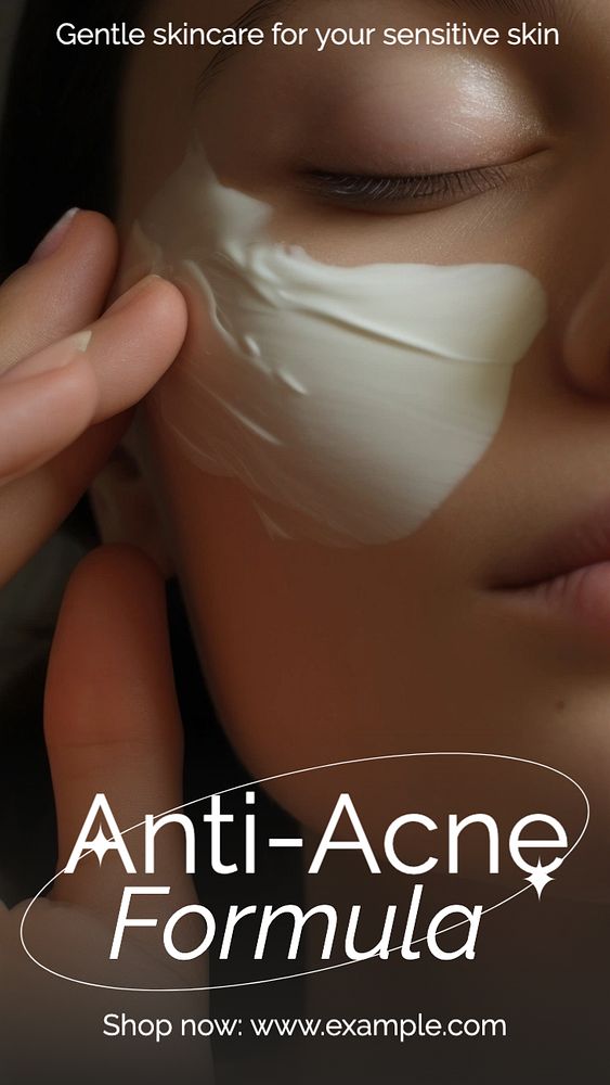 Anti-acne skincare Instagram story template, editable text