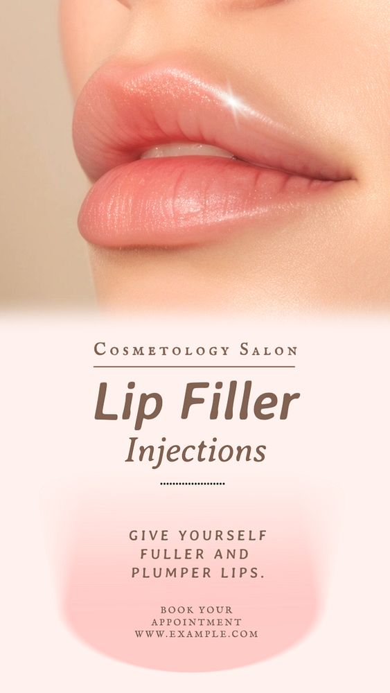 Lip filer injections Instagram story template, editable text