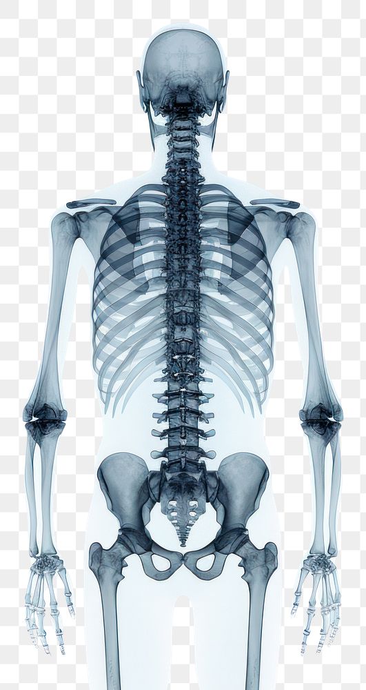 PNG X-ray white background fracture skeleton.