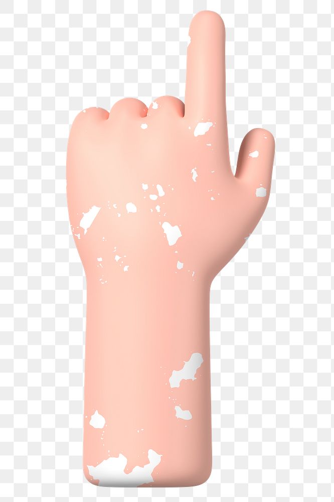 Finger-pointing hand png gesture, vitiligo awareness, 3D illustration, transparent background