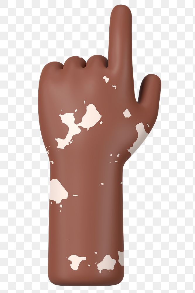 Finger-pointing hand png gesture, vitiligo awareness, 3D illustration, transparent background