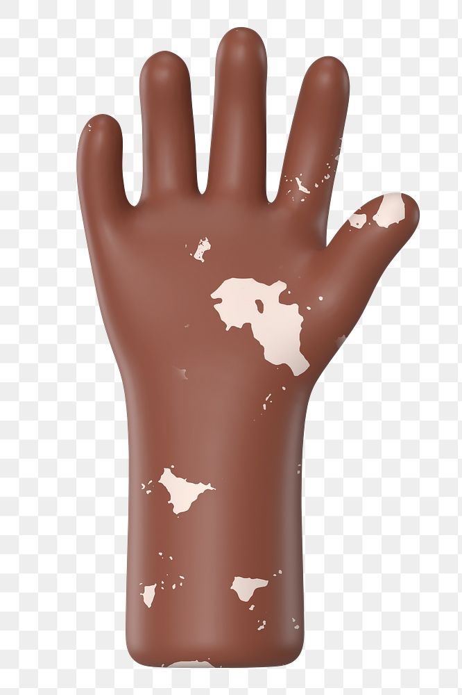 Raised vitiligo hand png gesture, 3D illustration, transparent background