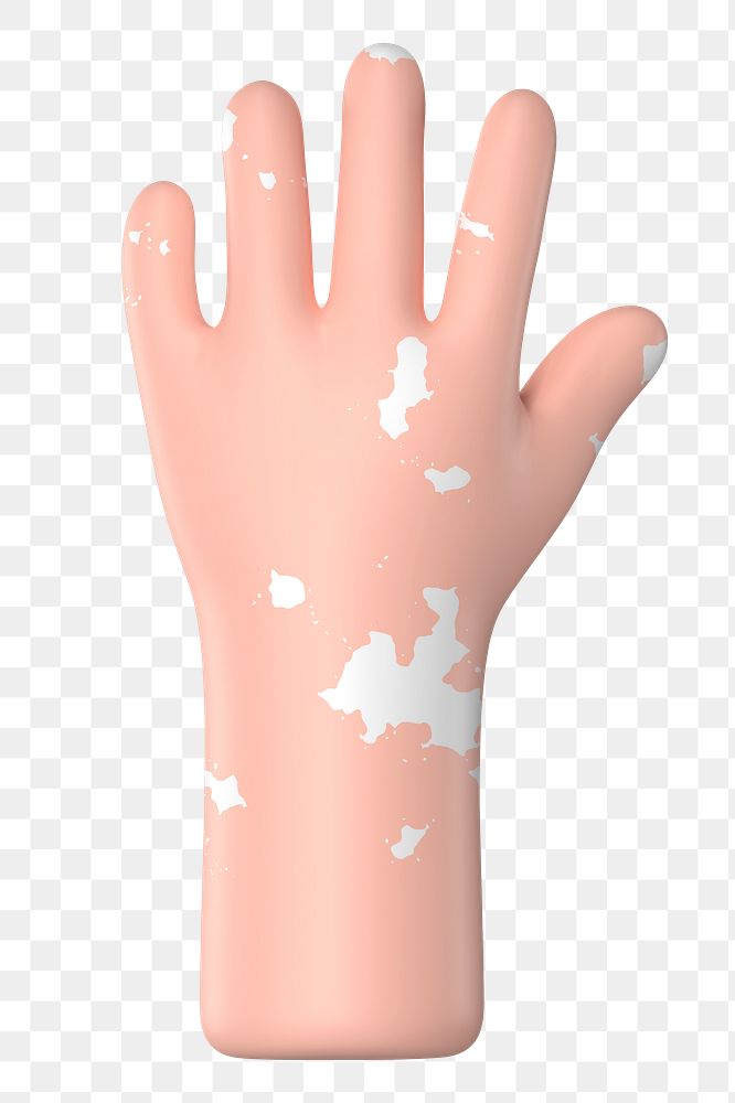 Raised vitiligo hand png gesture, 3D illustration, transparent background