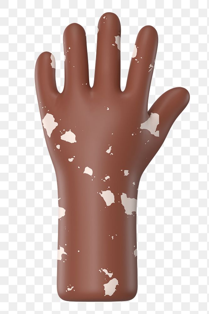 Raised vitiligo hand png gesture, 3D illustration, transparent background