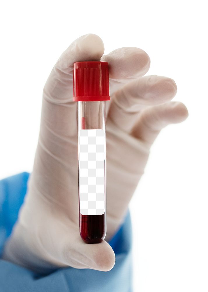 Doctor holding a blood test tube transparent png