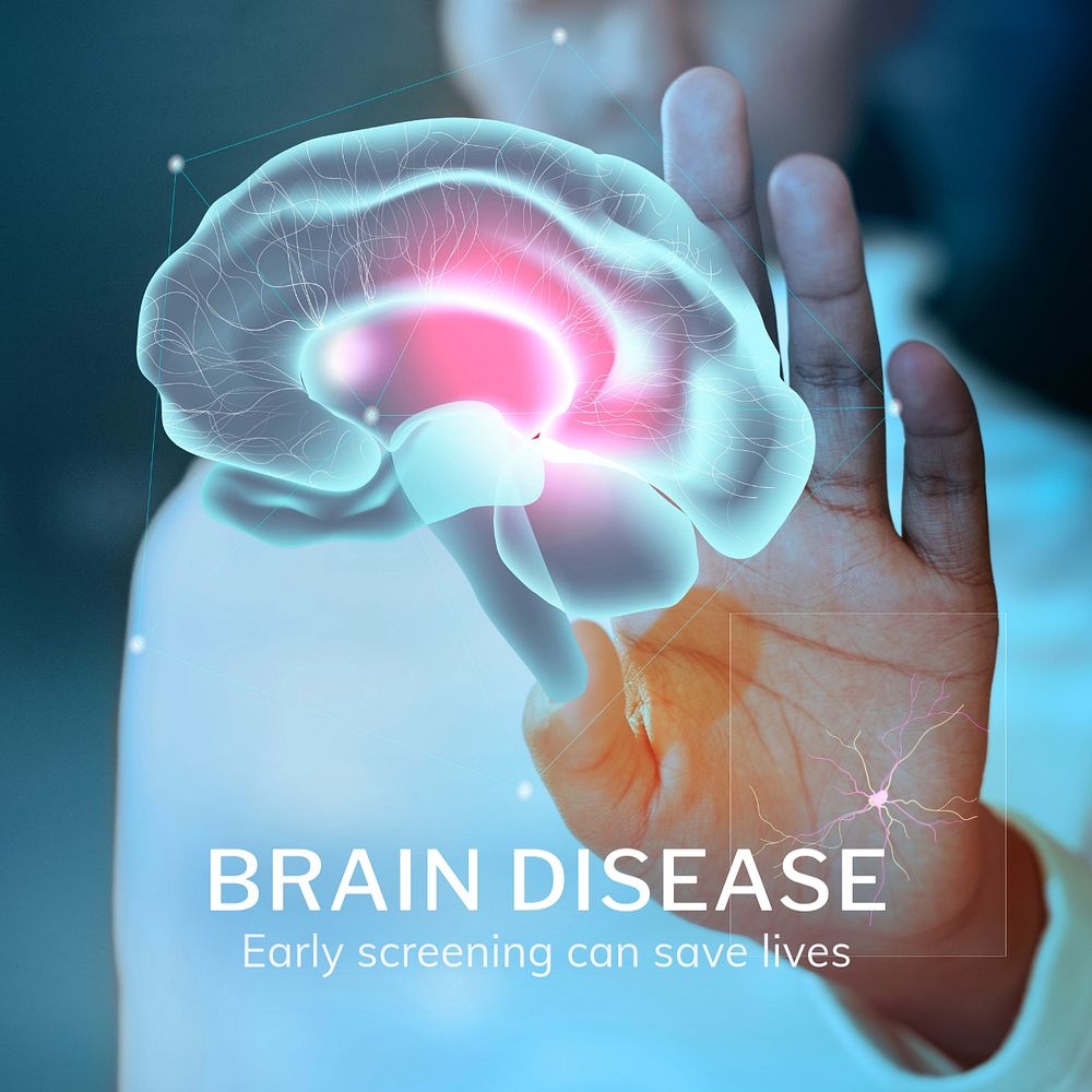 Brain disease Instagram post template, editable medical technology design