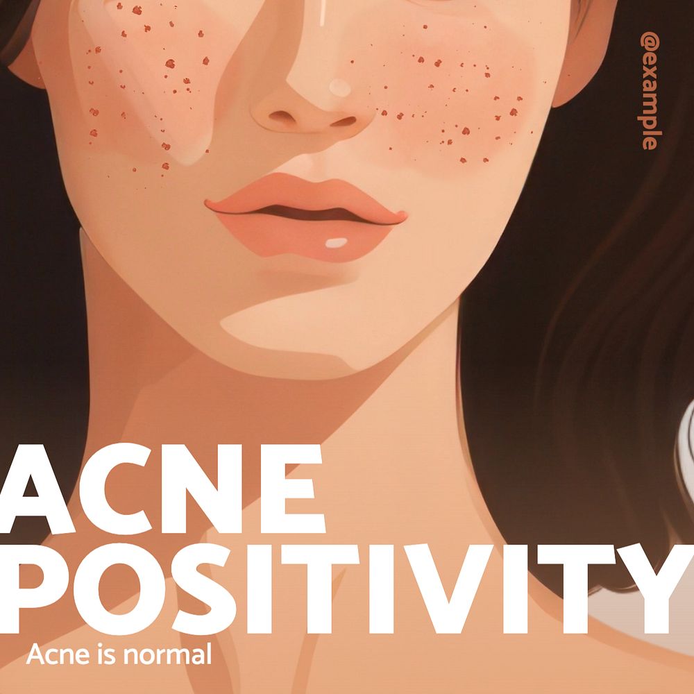 Acne positivity Instagram post template, editable text