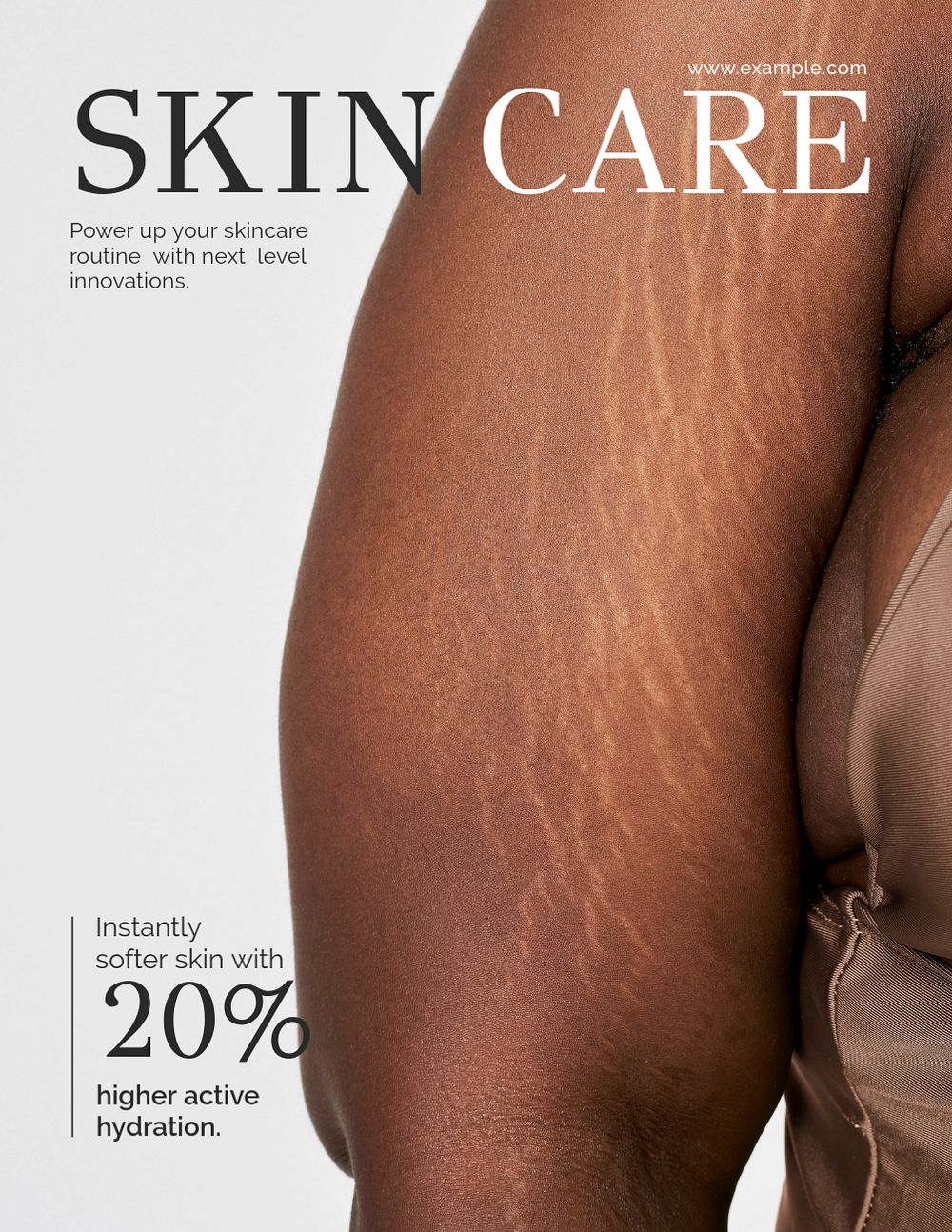 Body positivity flyer editable template, stretch marks photo