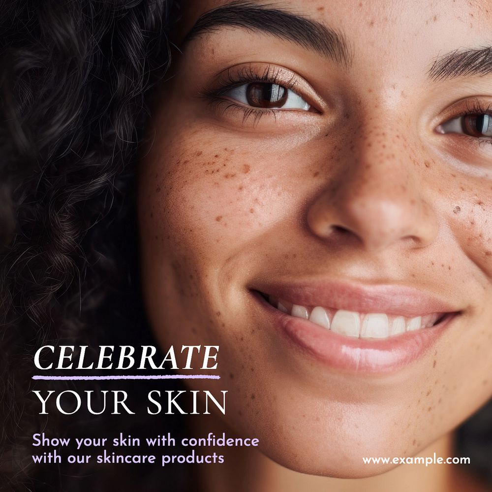 Celebrate your skin Instagram post template, editable text