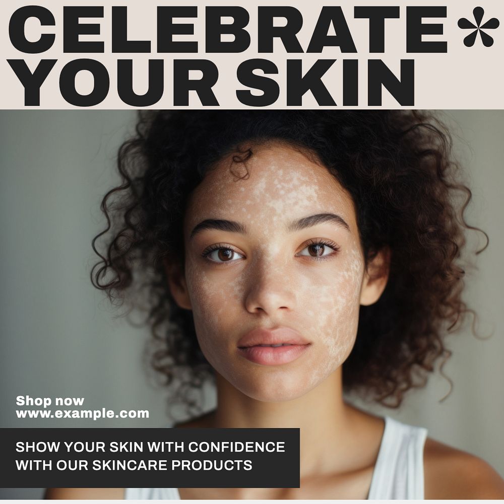 Celebrate your skin Instagram post template, editable text