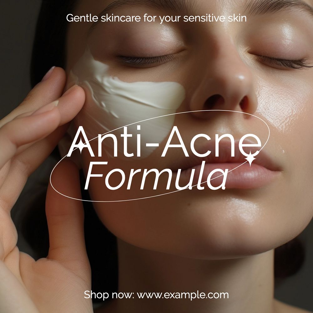 Anti-acne skincare Instagram post template, editable text