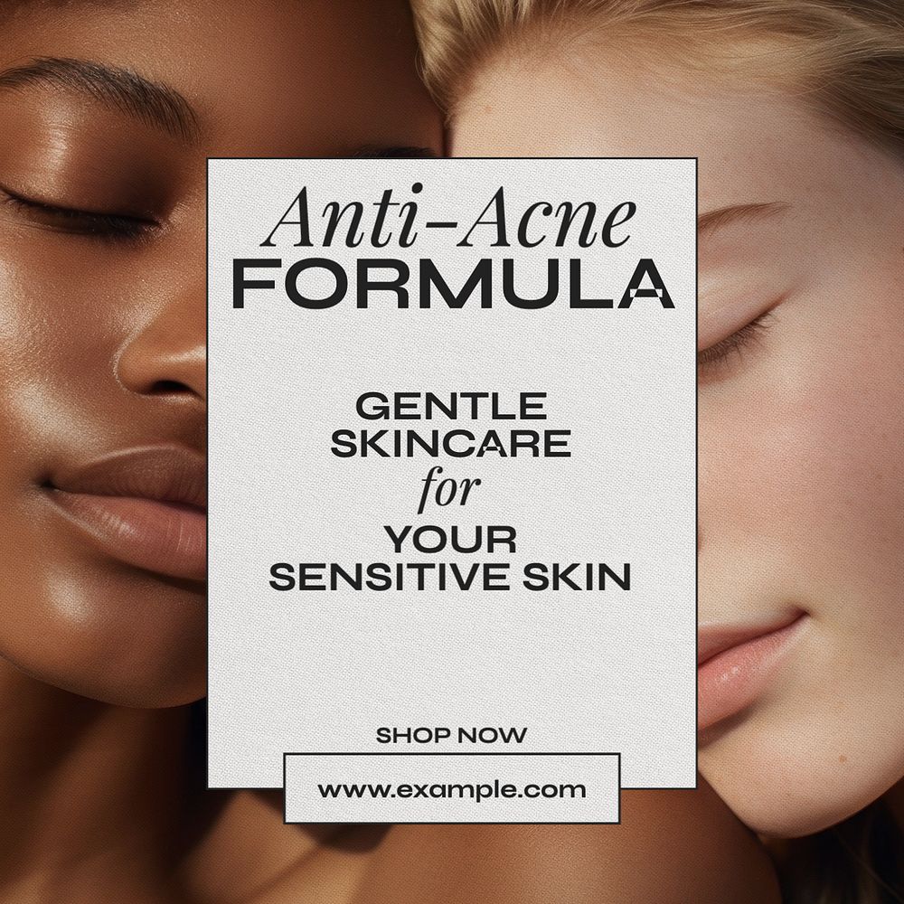 Anti-acne skincare Instagram post template