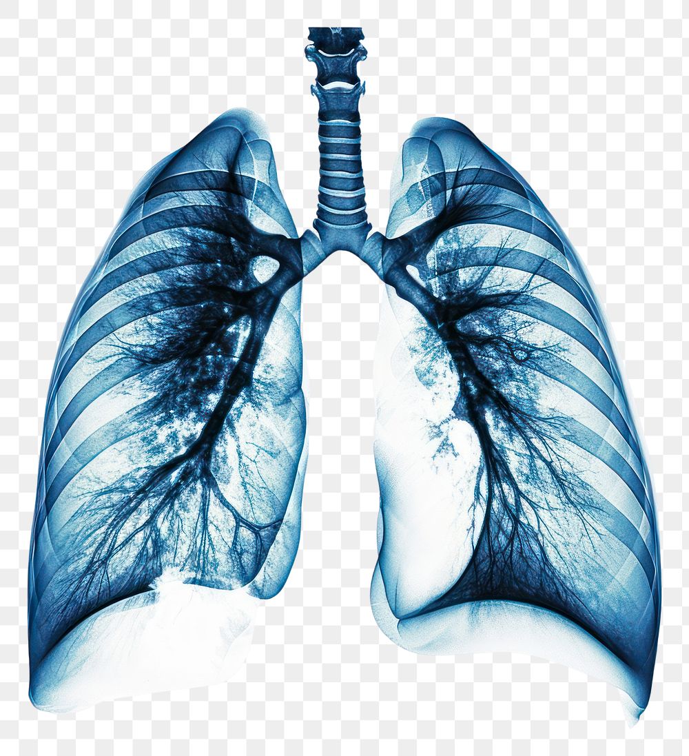 PNG X-ray picture of lungs white background tomography fracture.