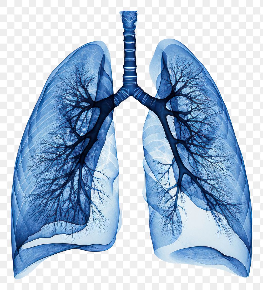 PNG X-ray picture of lungs white background accessories tomography.