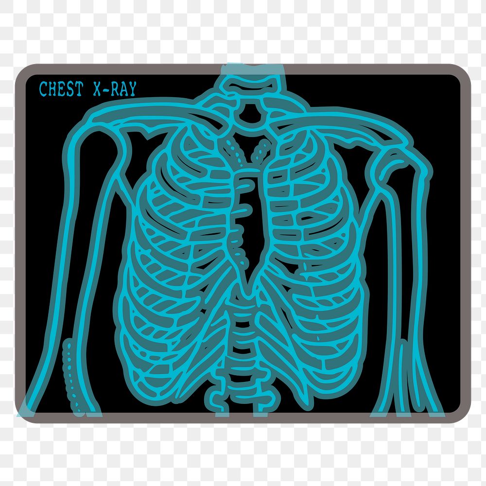 Chest X-ray png sticker, medical illustration on transparent background. Free public domain CC0 image.