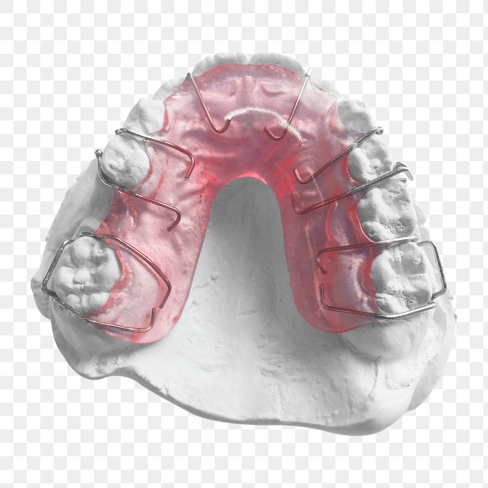 Orthodontic retainer png sticker, transparent background