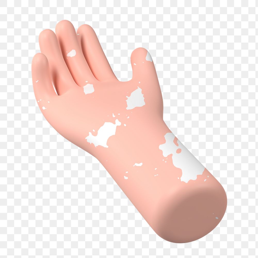 Helping hand gesture png, vitiligo awareness, 3D illustration, transparent background