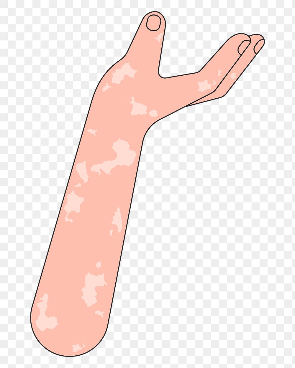 PNG Vitiligo presenting hand, gesture flat illustration, transparent background