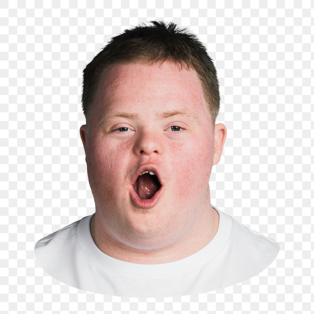 Boy yawning png, kid with down syndrome sticker, transparent background