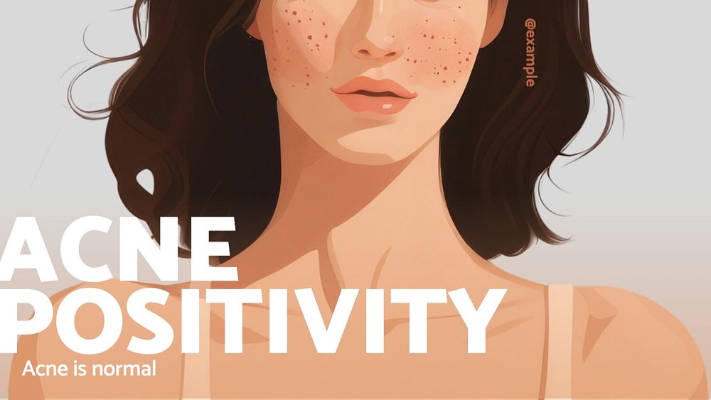 Acne positivity blog banner template