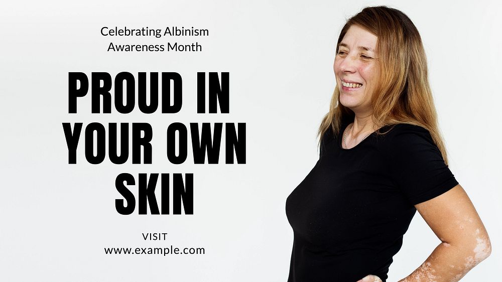 Albinism awareness month blog banner template