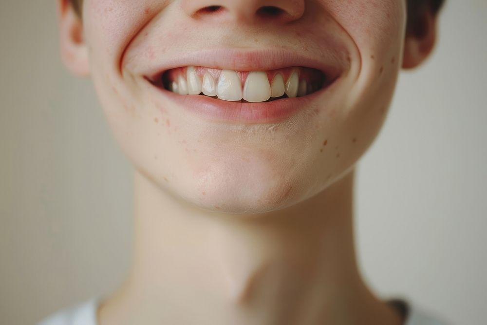 Boy smile and teeth with retainer person human happy.