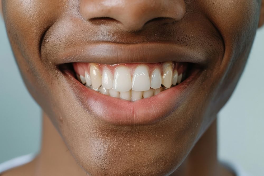 Boy smile and teeth with retainer person mouth human.