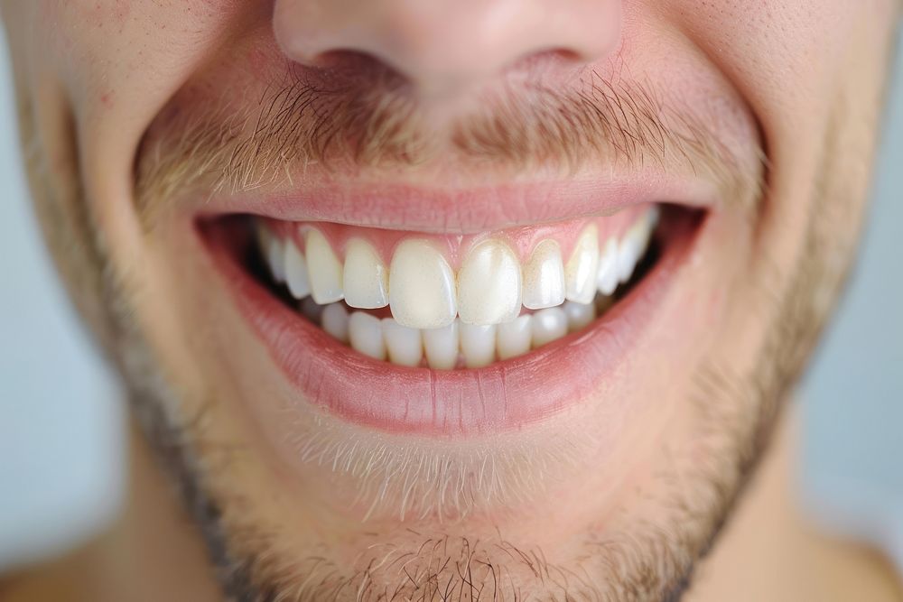 Man take teeth color palette whiten medication person mouth.