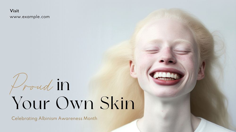 Albinism awareness month blog banner template