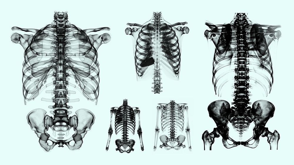 human body x ray design | Free Photo - rawpixel