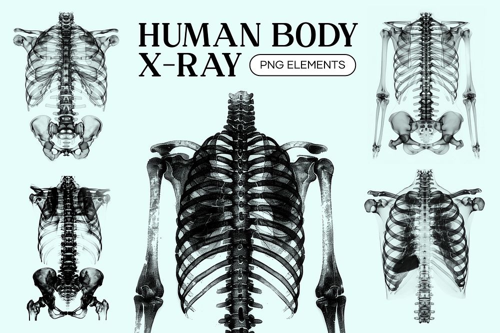 human body x ray design | Free Photo - rawpixel