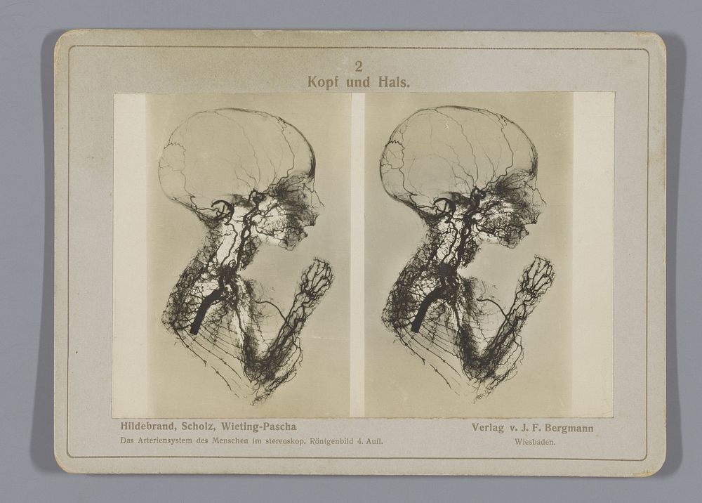 Röntgenopname van een kind (1917) by Otto Hildebrand, Wilhelm Scholz, Julius Menno Wieting Pascha and Joseph Friedrich…