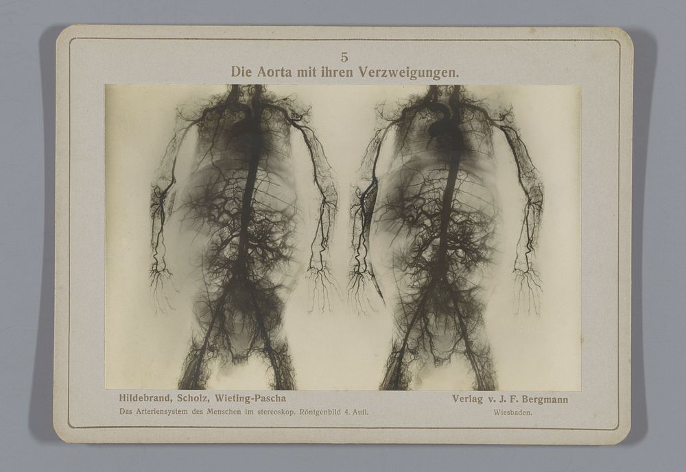 Röntgenopname van de aorta en de vertakkingen naar andere bloedvaten (1917) by Otto Hildebrand, Wilhelm Scholz, Julius Menno…