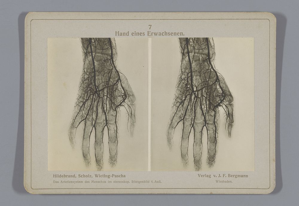 Röntgenopname van een hand van een volwassene (1917) by Otto Hildebrand, Wilhelm Scholz, Julius Menno Wieting Pascha and…