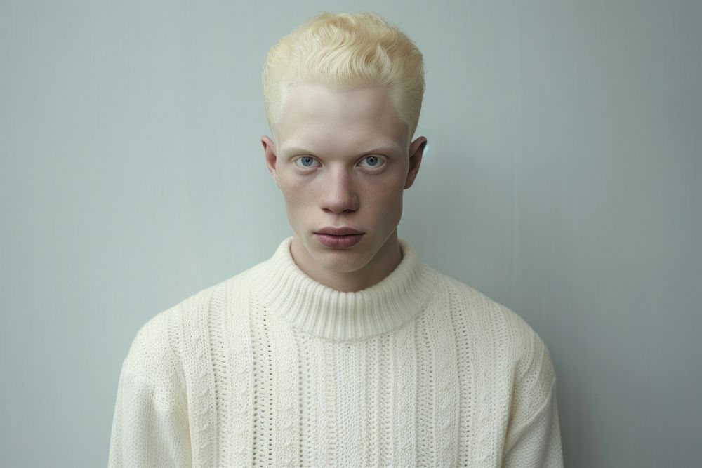 Half albino african male sweater portrait individuality.