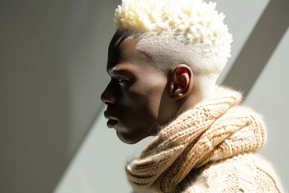 Half albino african male adult hairstyle portrait.