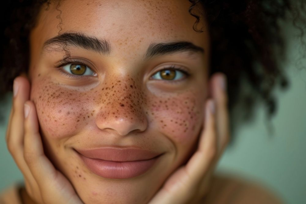 Happy multiracial young woman with a face full of acnes skin hairstyle happiness.