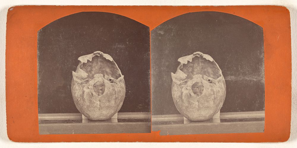 Base View of a Cranium. From an ancient tumulus near Fort Wadsworth, Dakota Territory.