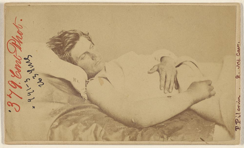 F. Pilgrim. Co. D. 8 N.Y. Cav. admitted April 5 1865 to Harewood Hospital. by William H Bell
