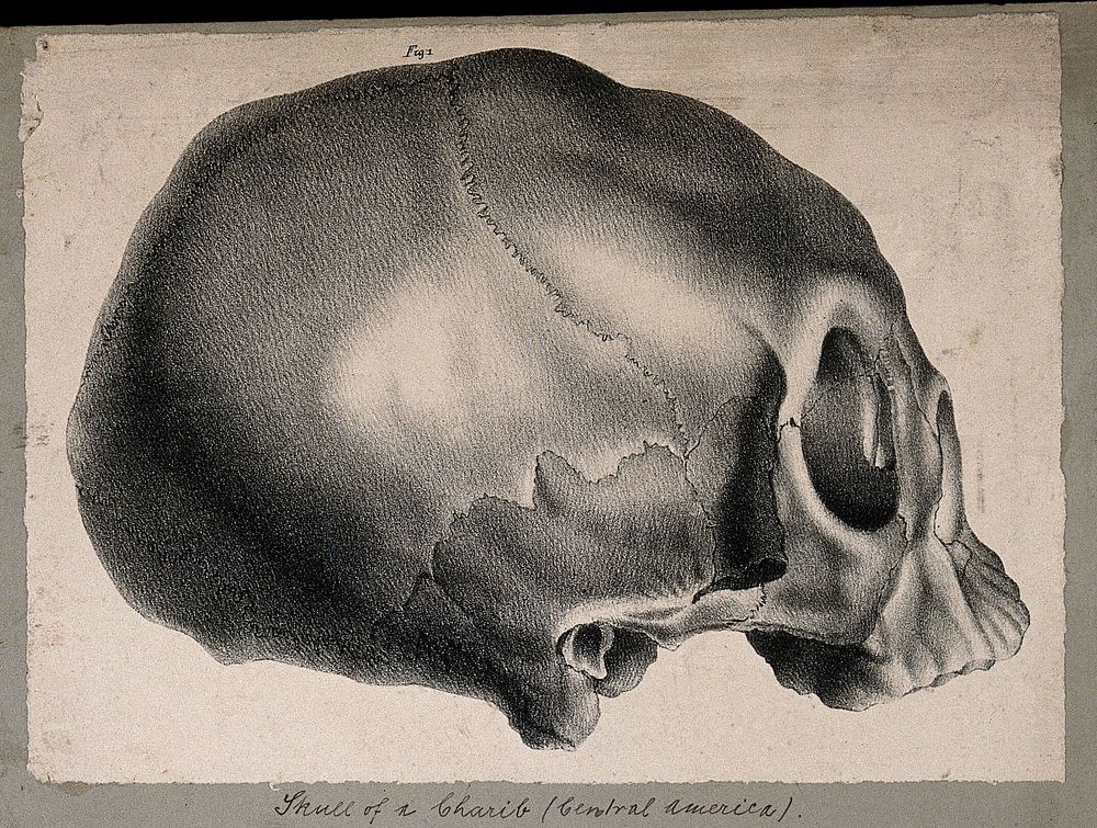 Skull of a Caribbean person: side view. Lithograph by Engelmann after C.P. Mazer.