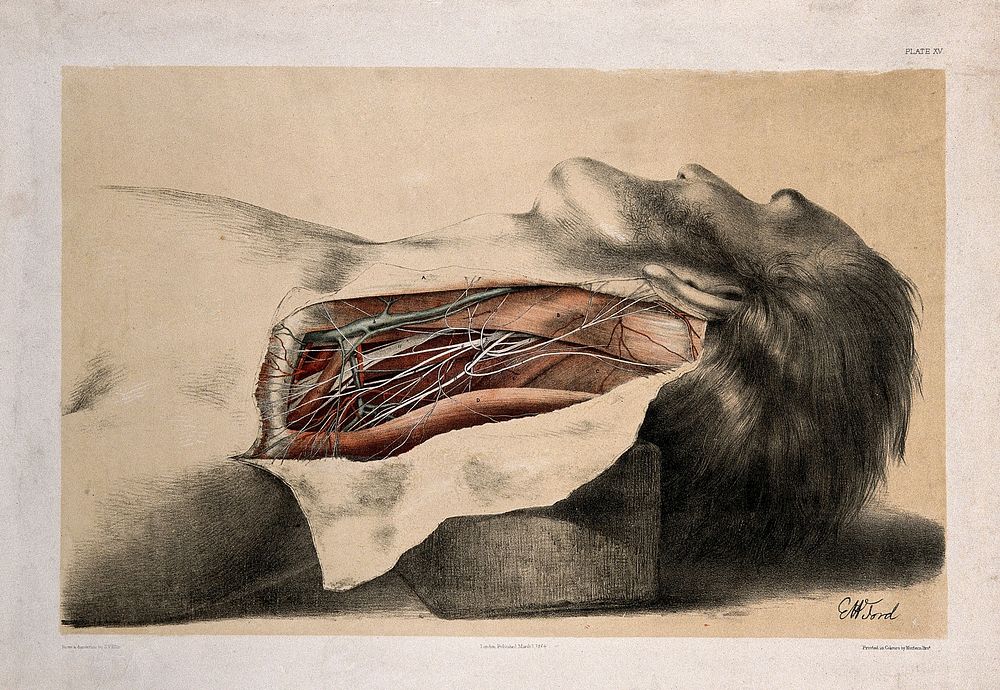 Dissection of the side of the neck. Colour lithograph by G.H. Ford, 1864.