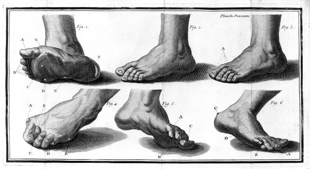 Chiropodologia, or, A scientific enquiry into the causes of corns, warts, onions, and other painful or offensive cutaneous…