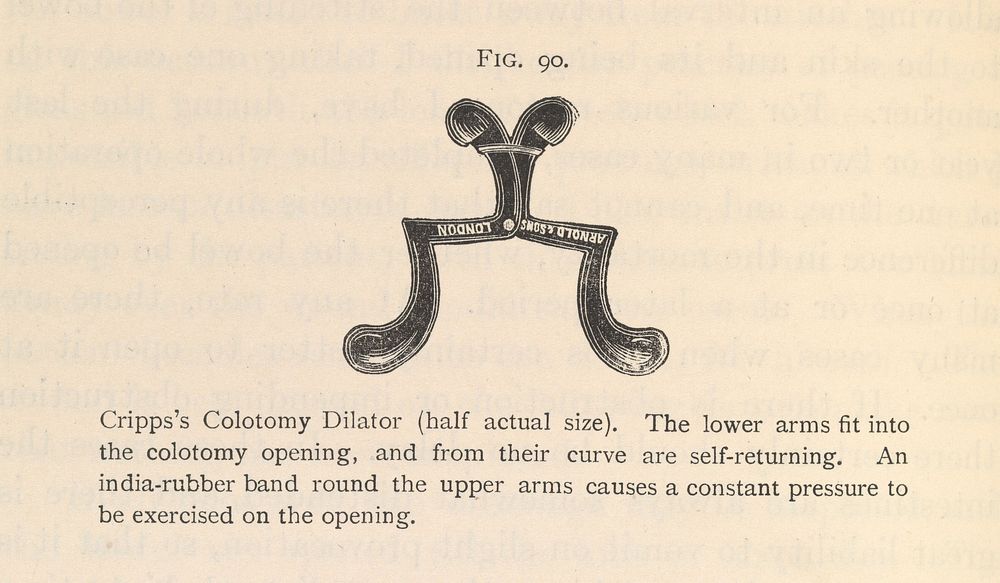 Fig. 90. Cripps Colotomy Dilator