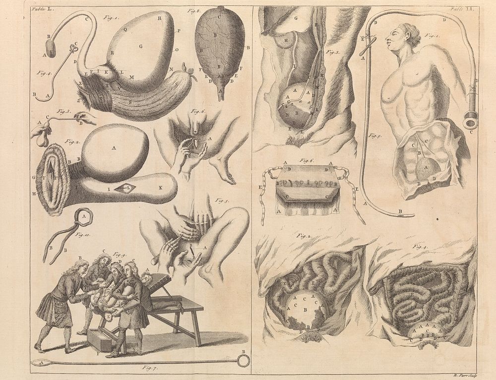 Table L-LI. A medicinal dictionary, 1743-45.